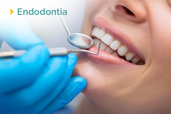 Endodontia O Conhecido Popularmente Tratamento De Canal Andrade Odontologia Especializada